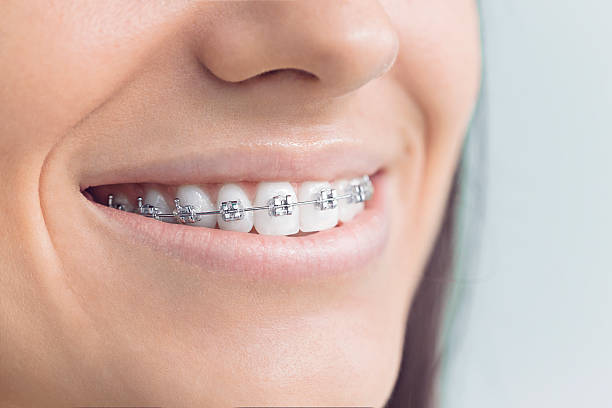Best Tooth Extraction  in Eulyptus Hills, CA